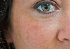 10 Home Remedies for Age Spots Helps Improve the Appearance of Your Skin