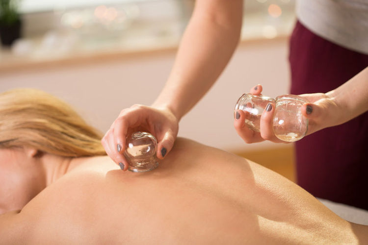 13 Extraordinary Benefits of Cupping Therapy That You Should Know
