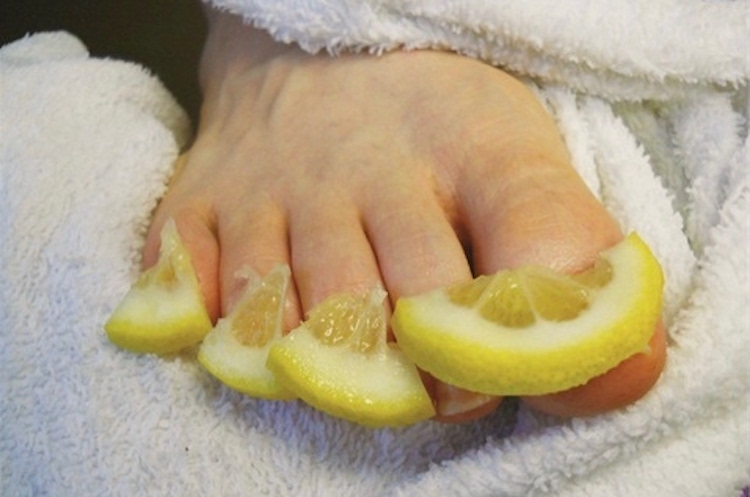 10 Effective Home Remedies For Getting Rid Of Toenail Fungus