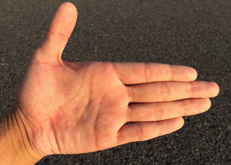 10 Simple Remedies For Dry, Chapped, and Cracked Hands