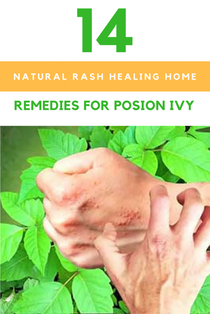 14 Natural Rash Healing Home Remedies For Poison Ivy