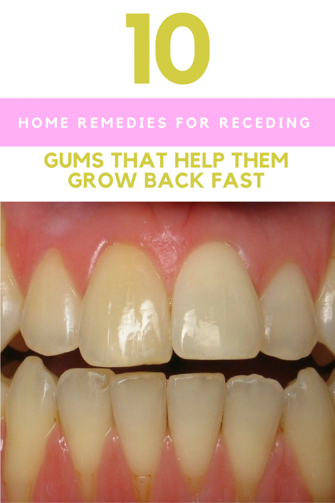 receding gums ideahacks resuscitate